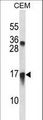 CXCL11 Antibody - CXCL11 Antibody western blot of CEM cell line lysates (35 ug/lane). The CXCL11 antibody detected the CXCL11 protein (arrow).