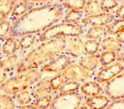 CXCL11 Antibody - Immunohistochemistry of paraffin-embedded human kidney tissue using Cxcl11 Antibody at dilution of 1:100