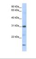 CXCL16 Antibody - Transfected 293T cell lysate. Antibody concentration: 1.0 ug/ml. Gel concentration: 12%.  This image was taken for the unconjugated form of this product. Other forms have not been tested.