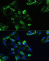 CXCR5 Antibody - Immunofluorescence analysis of U2OS cells using CXCR5 antibody at dilution of 1:100. Blue: DAPI for nuclear staining.