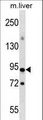 CXXC1 / CGBP Antibody - CXXC1 Antibody western blot of mouse liver tissue lysates (35 ug/lane). The CXXC1 antibody detected the CXXC1 protein (arrow).