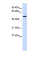 CYB561 Antibody - CYB561 antibody Western blot of HeLa lysate. This image was taken for the unconjugated form of this product. Other forms have not been tested.