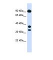 CYB561 Antibody - Western blot of Human 293T. CYB561 antibody dilution 1.0 ug/ml.  This image was taken for the unconjugated form of this product. Other forms have not been tested.