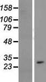 CYB561D1 Protein - Western validation with an anti-DDK antibody * L: Control HEK293 lysate R: Over-expression lysate
