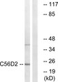 CYB561D2 Antibody - Western blot analysis of lysates from Jurkat cells, using C56D2 Antibody. The lane on the right is blocked with the synthesized peptide.