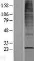 CYB561D2 Protein - Western validation with an anti-DDK antibody * L: Control HEK293 lysate R: Over-expression lysate