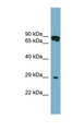 CYB5D1 Antibody - CYB5D1 antibody Western blot of COLO205 cell lysate. This image was taken for the unconjugated form of this product. Other forms have not been tested.