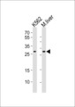 CYB5R2 Antibody - Western blot of lysates from K562 cell line, mouse liver tissue lysate (from left to right) with CYB5R2 Antibody. Antibody was diluted at 1:1000 at each lane. A goat anti-rabbit IgG H&L (HRP) at 1:10000 dilution was used as the secondary antibody. Lysates at 35 ug per lane.