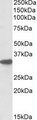 CYB5R3 / B5R Antibody - CYB5R3 antibody (0.1 ug/ml) staining of Mouse Liver lysate (RIPA buffer, 35 ug total protein per lane). Primary incubated for 1 hour. Detected by Western blot of chemiluminescence.