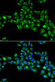 CYGB / Cytoglobin Antibody - Immunofluorescence analysis of HeLa cells.