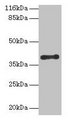 CYLC2 Antibody - Western blot All lanes: CYLC2 antibody at 12µg/ml + 293T cells Secondary Goat polyclonal to rabbit IgG at 1/10000 dilution Predicted band size: 39 kDa Observed band size: 39 kDa