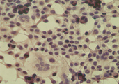 CYLD Antibody - ICC staining of HeLa cell using control (rabbit Ig) at 5 ug/ml.