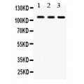 CYLD Antibody - CYLD antibody Western blot. All lanes: Anti CYLD at 0.5 ug/ml. Lane 1: Rat Testis Tissue Lysate at 50 ug. Lane 2: Rat Brain Tissue Lysate at 50 ug. Lane 3: HELA Whole Cell Lysate at 40 ug. Predicted band size: 107 kD. Observed band size: 107 kD.