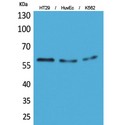 CYP11B1+2 Antibody - Western blot of CYP11B1/2 antibody