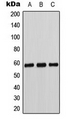Antibody - Western blot analysis of Cytochrome P450 11B1/2 expression in K562 (A); Caki1 (B); MCF7 (C) whole cell lysates.