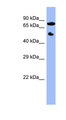 CYP11B2 / Aldosterone Synthase Antibody - CYP11B2 antibody Western blot of OVCAR-3 cell lysate. This image was taken for the unconjugated form of this product. Other forms have not been tested.