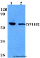 CYP11B2 / Aldosterone Synthase Antibody - Western blot of CYP11B2 antibody at 1:500 dilution. Lane 1: HEK293T whole cell lysate. Lane 2: Raw264.7 whole cell lysate.