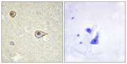 CYP19 / Aromatase Antibody - Immunohistochemistry analysis of paraffin-embedded human brain tissue, using Cytochrome P450 19A1 Antibody. The picture on the right is blocked with the synthesized peptide.