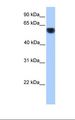 CYP1A1 Antibody - Fetal heart lysate. Antibody concentration: 1.0 ug/ml. Gel concentration: 12%.  This image was taken for the unconjugated form of this product. Other forms have not been tested.