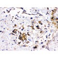 CYP1A2 Antibody - CYP1A2 antibody IHC-paraffin. IHC(P): Human Liver Cancer Tissue.