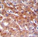 CYP1A2 Antibody - CYP1A2 Antibody immunohistochemistry of formalin-fixed and paraffin-embedded human liver tissue followed by peroxidase-conjugated secondary antibody and DAB staining.