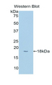 CYP1B1 Antibody - Western blot of recombinant CYP1B1.  This image was taken for the unconjugated form of this product. Other forms have not been tested.