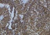 CYP1B1 Antibody - 1:100 staining mouse testis tissue by IHC-P. The sample was formaldehyde fixed and a heat mediated antigen retrieval step in citrate buffer was performed. The sample was then blocked and incubated with the antibody for 1.5 hours at 22°C. An HRP conjugated goat anti-rabbit antibody was used as the secondary.