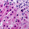 CYP21A2 Antibody - Immunohistochemical analysis of Cytochrome P450 21A2 staining in human liver formalin fixed paraffin embedded tissue section. The section was pre-treated using heat mediated antigen retrieval with sodium citrate buffer (pH 6.0). The section was then incubated with the antibody at room temperature and detected using an HRP conjugated compact polymer system. DAB was used as the chromogen. The section was then counterstained with hematoxylin and mounted with DPX.