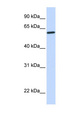 CYP27 / CYP27A1 Antibody - CYP27A1 antibody Western blot of Fetal Brain lysate. This image was taken for the unconjugated form of this product. Other forms have not been tested.