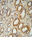 CYP27B1 Antibody - CYP27B1 Antibody immunohistochemistry of formalin-fixed and paraffin-embedded human kidney tissue followed by peroxidase-conjugated secondary antibody and DAB staining.