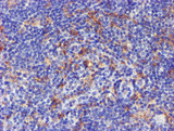 CYP2A6 Antibody - IHC of paraffin-embedded Human lymphoma tissue using anti-CYP2A6 mouse monoclonal antibody. (Heat-induced epitope retrieval by 10mM citric buffer, pH6.0, 100C for 10min).