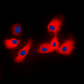 CYP2A6 Antibody - Immunofluorescent analysis of Cytochrome P450 2A6 staining in HeLa cells. Formalin-fixed cells were permeabilized with 0.1% Triton X-100 in TBS for 5-10 minutes and blocked with 3% BSA-PBS for 30 minutes at room temperature. Cells were probed with the primary antibody in 3% BSA-PBS and incubated overnight at 4 C in a humidified chamber. Cells were washed with PBST and incubated with a DyLight 594-conjugated secondary antibody (red) in PBS at room temperature in the dark. DAPI was used to stain the cell nuclei (blue).
