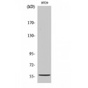 CYP2B6 Antibody - Western blot of CYP2B6 antibody
