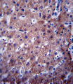 CYP2C19 Antibody - CYP2C19 Antibody immunohistochemistry of formalin-fixed and paraffin-embedded human liver tissue followed by peroxidase-conjugated secondary antibody and DAB staining.