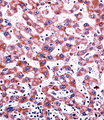 CYP2C9 / Cytochrome P450 2C9 Antibody - CYP2C9 Antibody immunohistochemistry of formalin-fixed and paraffin-embedded human liver tissue followed by peroxidase-conjugated secondary antibody and DAB staining.