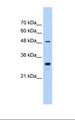 CYP2C9 / Cytochrome P450 2C9 Antibody - Jurkat cell lysate. Antibody concentration: 0.25 ug/ml. Gel concentration: 12%.  This image was taken for the unconjugated form of this product. Other forms have not been tested.
