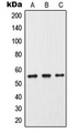 CYP2C9 / Cytochrome P450 2C9 Antibody - Western blot analysis of Cytochrome P450 2C9 expression in HeLa (A); Raw264.7 (B); PC12 (C) whole cell lysates.