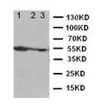 CYP2D6 Antibody - WB of CYP2D6 antibody. Lane 1: Rat Liver Tissue Lysate. Lane 2: Rat Kidney Tissue Lysate. Lane 3: Rat Brain Tissue Lysate.