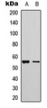 CYP2D6 Antibody - Western blot analysis of Cytochrome P450 2D6 expression in HeLa (A); HEK293T (B) whole cell lysates.