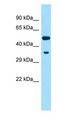 Cyp2f4 Antibody - Cyp2f4 antibody Western Blot of Rat Muscle.  This image was taken for the unconjugated form of this product. Other forms have not been tested.