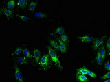 CYP2U1 Antibody - Immunofluorescent analysis of Hela cells using CYP2U1 Antibody at dilution of 1:100 and Alexa Fluor 488-congugated AffiniPure Goat Anti-Rabbit IgG(H+L)