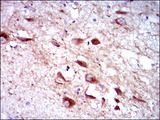 CYP3A4 / Cytochrome P450 3A4 Antibody - IHC of paraffin-embedded human brain tissues using CYP3A4 mouse monoclonal antibody with DAB staining.