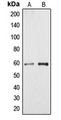CYP4A11+22 Antibody - Western blot analysis of Cytochrome P450 4A11/22 expression in HeLa (A); HUVEC (B) whole cell lysates.