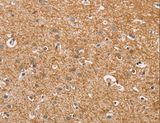 CYP4A11 Antibody - Immunohistochemistry of paraffin-embedded Human brain using CYP4A11 Polyclonal Antibody at dilution of 1:30.