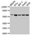CYP4F22 Antibody - Positive Western Blot detected in HEK293 whole cell lysate, Hela whole cell lysate, MCF-7 whole cell lysate, HepG2 whole cell lysate, A549 whole cell lysate. All lanes: CYP4F22 antibody at 3.2 µg/ml Secondary Goat polyclonal to rabbit IgG at 1/50000 dilution. Predicted band size: 62 KDa. Observed band size: 62 KDa