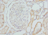 CYP4V2 Antibody - Immunohistochemistry of paraffin-embedded Human kidney tissue at dilution 1:100
