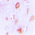 CYP4X1 Antibody - Immunohistochemical analysis of Cytochrome P450 4X1 staining in human brain formalin fixed paraffin embedded tissue section. The section was pre-treated using heat mediated antigen retrieval with sodium citrate buffer (pH 6.0). The section was then incubated with the antibody at room temperature and detected using an HRP conjugated compact polymer system. DAB was used as the chromogen. The section was then counterstained with hematoxylin and mounted with DPX.