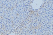 CYP7A1 Antibody - 1:100 staining mouse liver tissue by IHC-P. The sample was formaldehyde fixed and a heat mediated antigen retrieval step in citrate buffer was performed. The sample was then blocked and incubated with the antibody for 1.5 hours at 22°C. An HRP conjugated goat anti-rabbit antibody was used as the secondary.