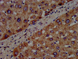CYP8B1 Antibody - Immunohistochemistry image at a dilution of 1:300 and staining in paraffin-embedded human liver tissue performed on a Leica BondTM system. After dewaxing and hydration, antigen retrieval was mediated by high pressure in a citrate buffer (pH 6.0) . Section was blocked with 10% normal goat serum 30min at RT. Then primary antibody (1% BSA) was incubated at 4 °C overnight. The primary is detected by a biotinylated secondary antibody and visualized using an HRP conjugated SP system.