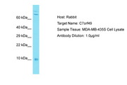 (CYREN) C7orf49 Antibody -  This image was taken for the unconjugated form of this product. Other forms have not been tested.